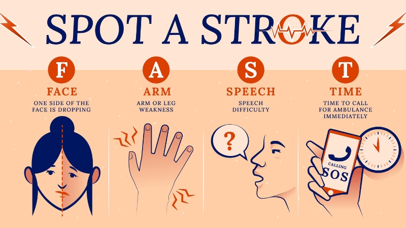 FAST Face Arms Speech Time Assessment At Poorni Health Care