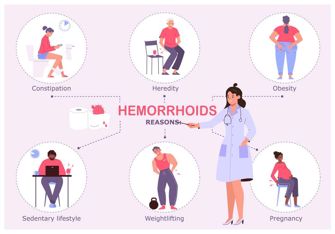 Effective Piles (Hemorrhoids) Treatment Options and Considerations at